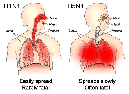 ابتلای انسان به آنفولانزای پرندگانH5N1